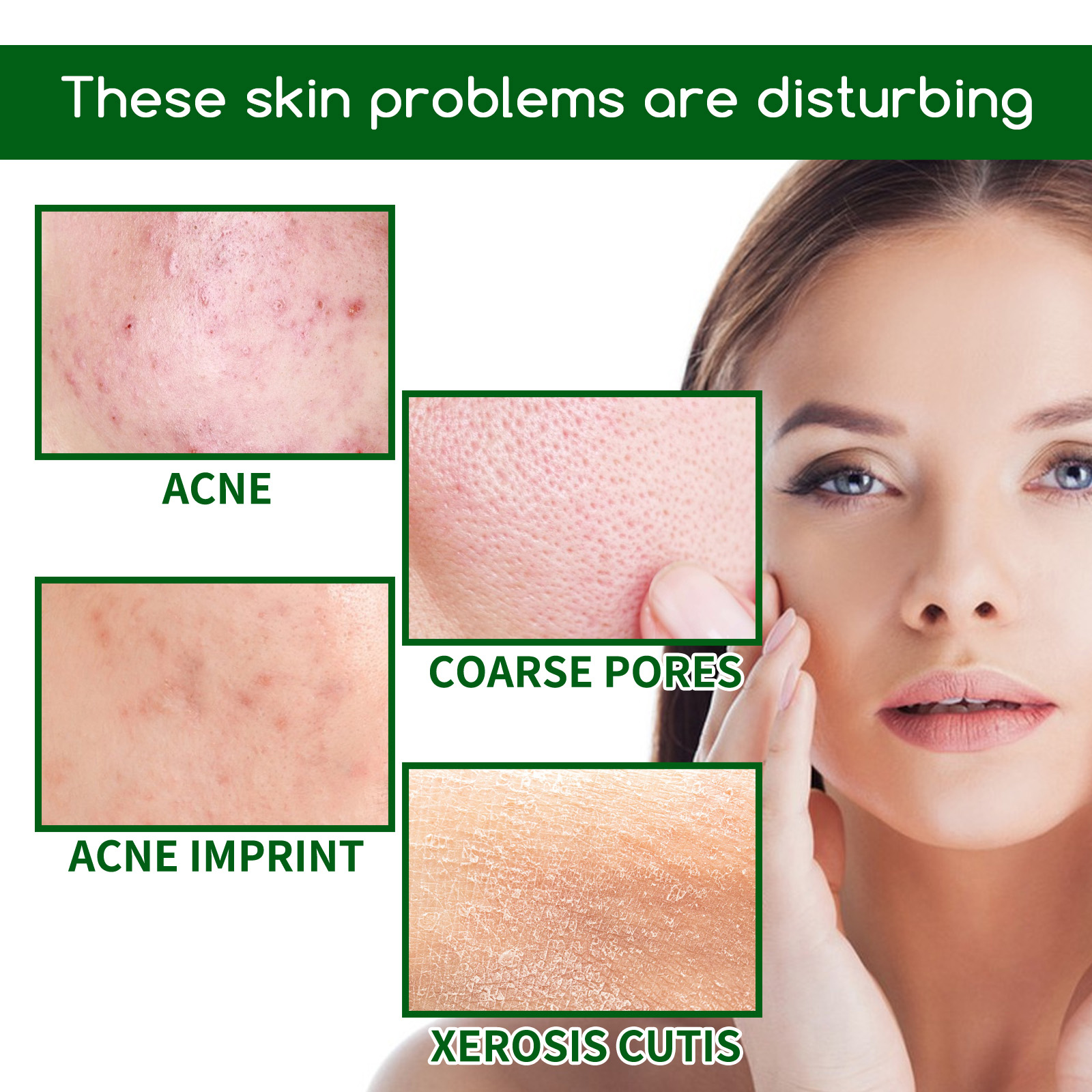 Salicylic Acid Anti Acn-e Face - Glycolic Acid Exfoliant recensione e prezzo