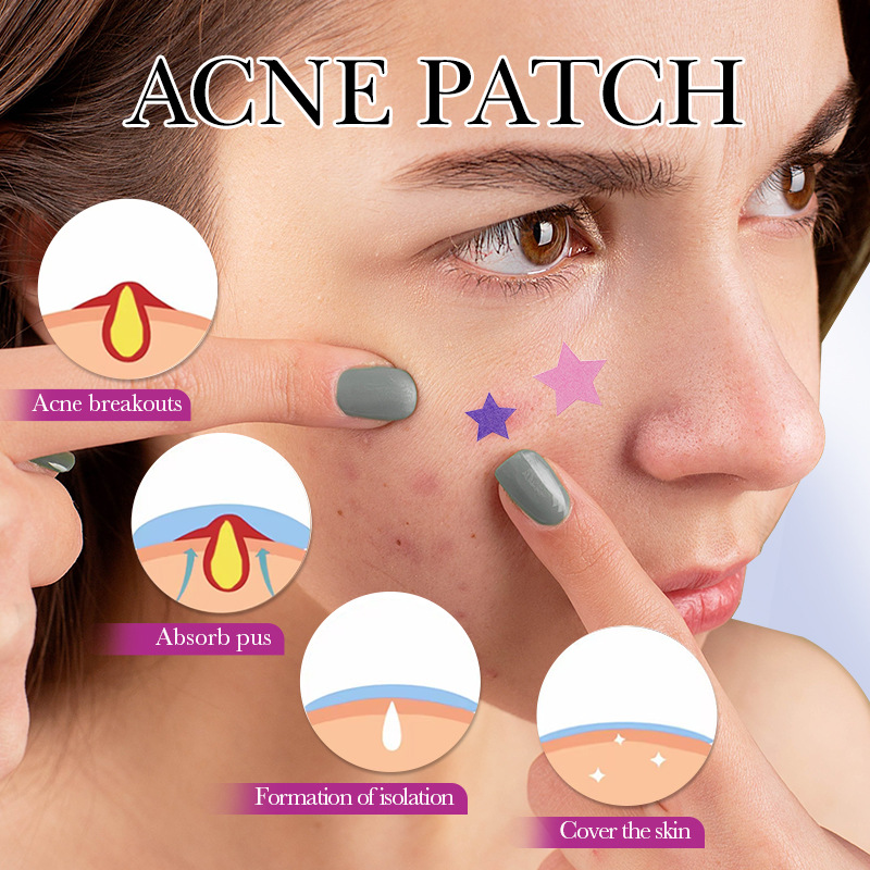 7/10/14Pcs Colorful Star Acne  - Skincare Qv recensione e prezzo