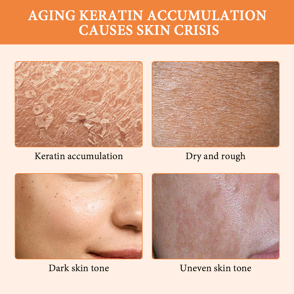 Orange Peeling Gel Scrub For B - Glycolic Acid Exfoliant recensione e prezzo