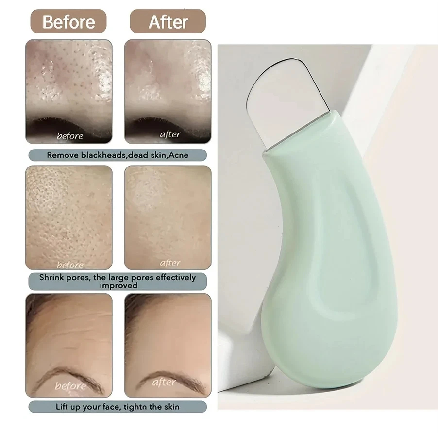 Professional Blackhead and Whi - Skincare Qv recensione e prezzo