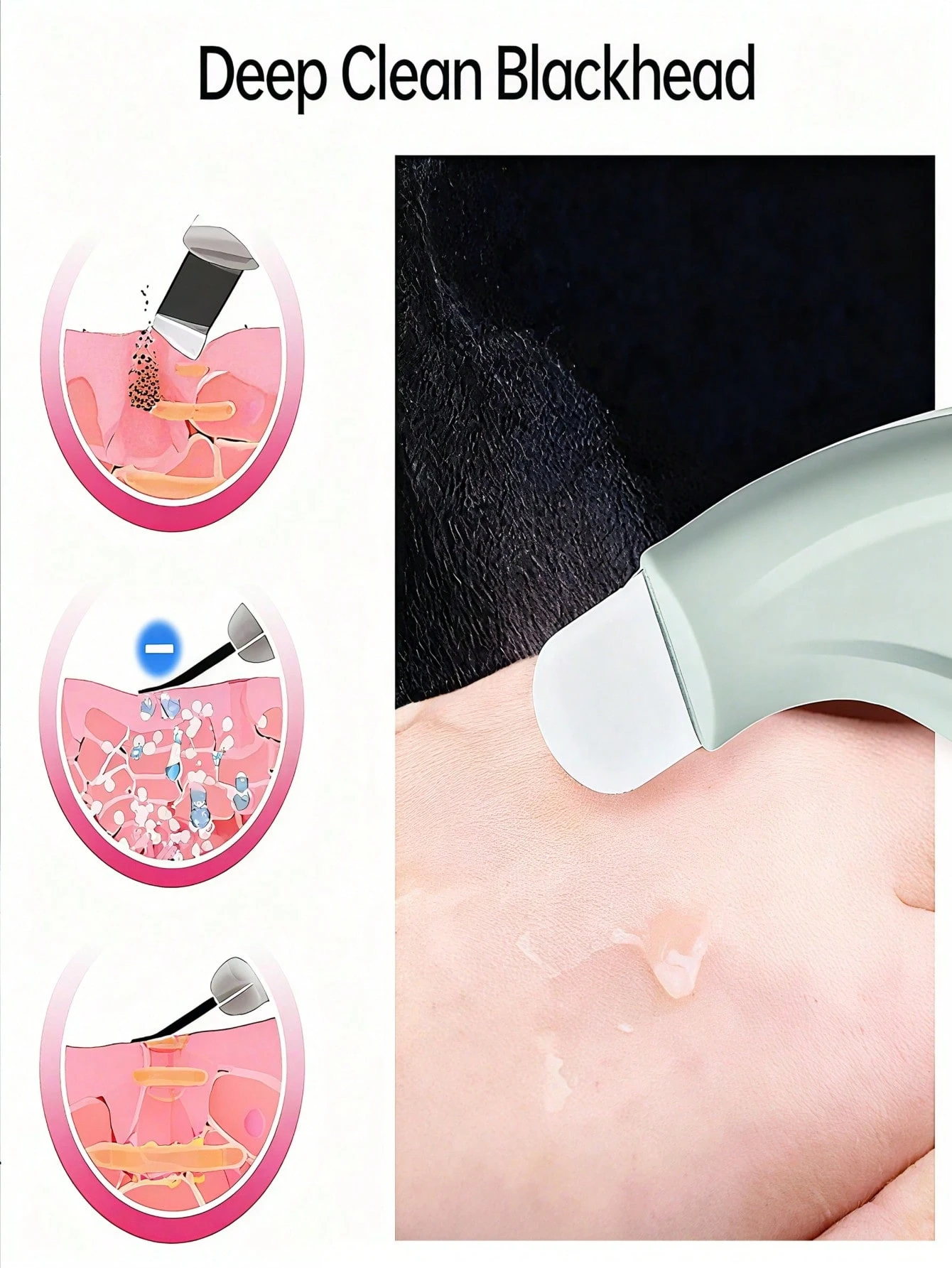 Professional Blackhead and Whi - Skincare Qv recensione e prezzo