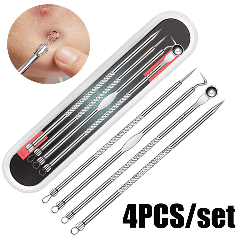 4pcs/set Acne Removal Needles  - Skincare Qv recensione e prezzo