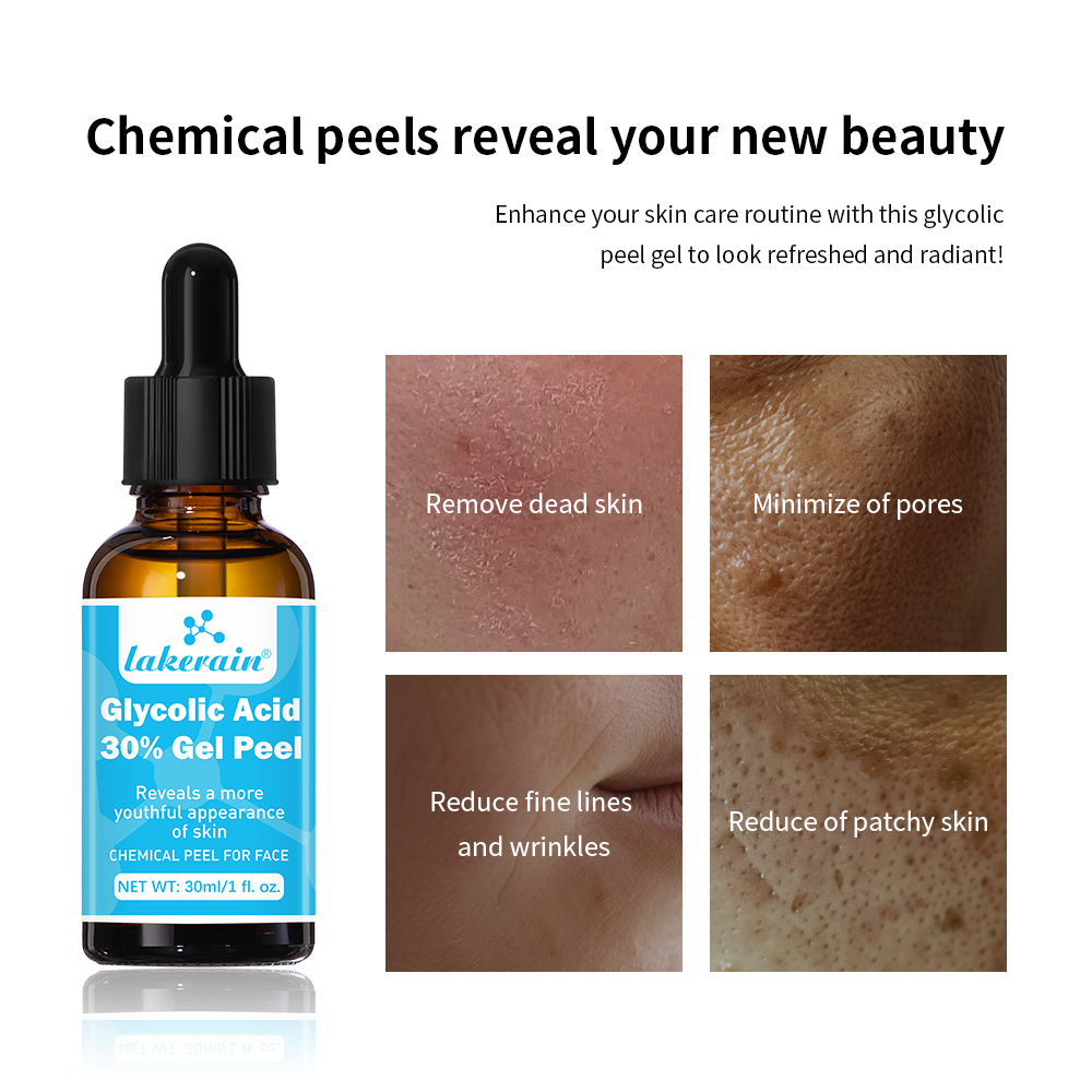 30% Glycolic Acid Peel Gel Pro - Glycolic Acid Exfoliant recensione e prezzo