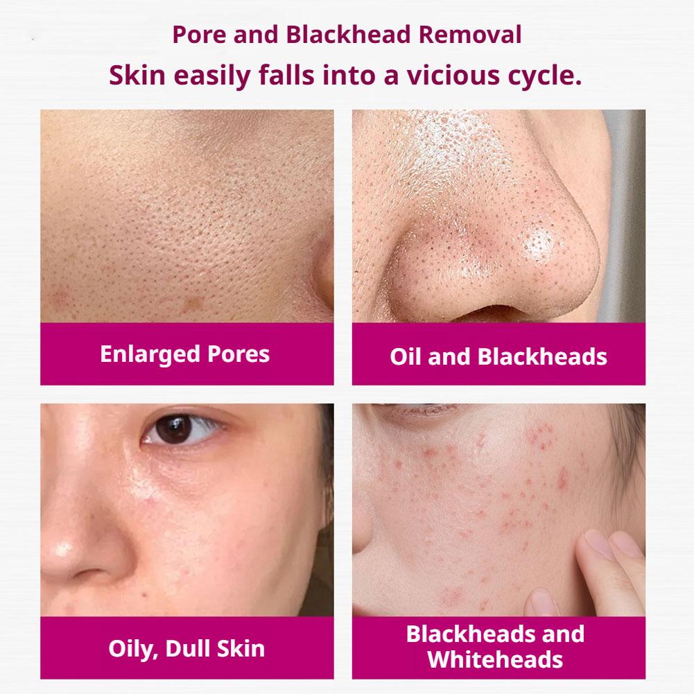 Salicylic Acid Shrink Pores Se - Glycolic Acid Exfoliant recensione e prezzo