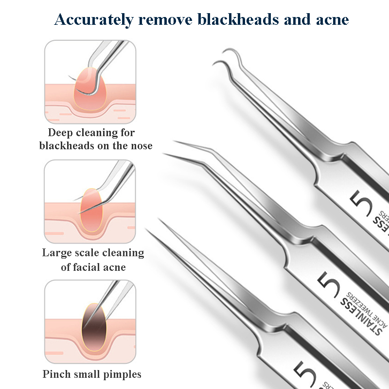 4-11Pcs Ingrown Hair Tweezers  - Skincare Qv recensione e prezzo