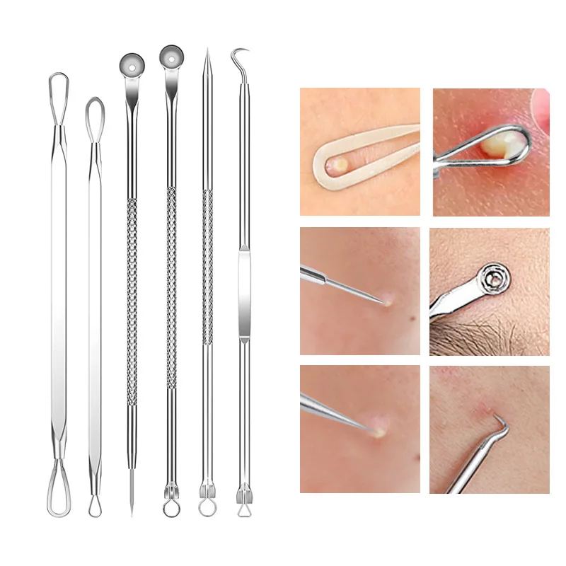 4-11Pcs Ingrown Hair Tweezers  - Skincare Qv recensione e prezzo