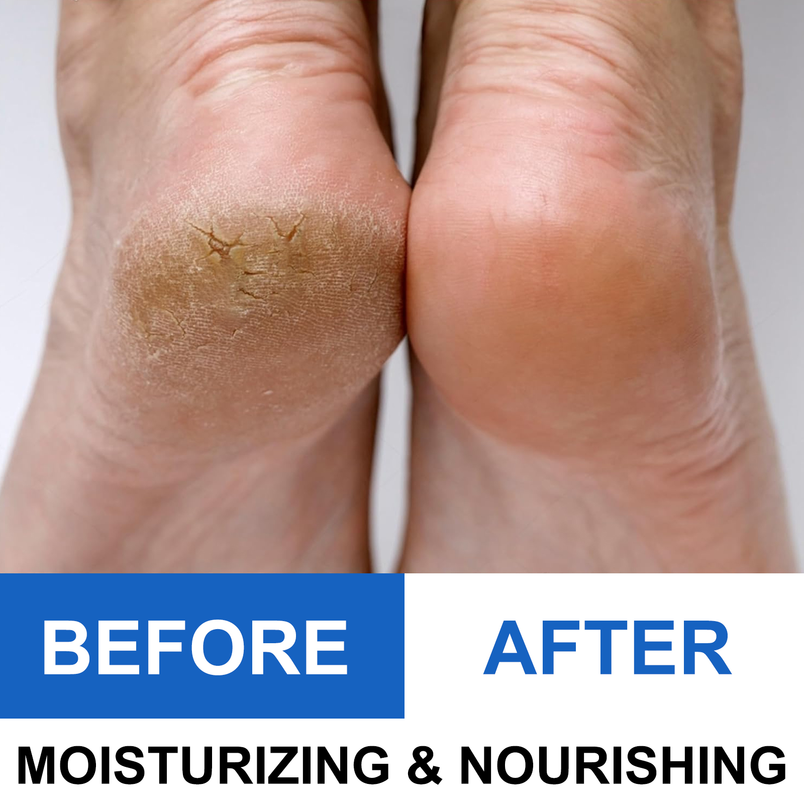 40% Urea Foot Cream Stick - Mo - Glycolic Acid Exfoliant recensione e prezzo